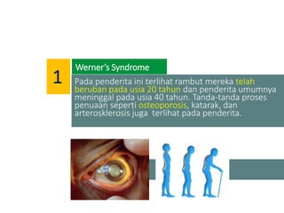Pada penderita ini terlihat rambut mereka telah
beruban pada usia 20 tahun dan penderita umumnya
meninggal pada usia 40 tahun. Tanda-tanda proses
penuaan seperti osteoporosis, katarak, dan
arterosklerosis juga terlihat pada penderita.
Werner’s Syndrome
1
 