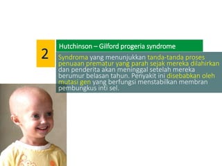 Syndroma yang menunjukkan tanda-tanda proses
penuaan prematur yang parah sejak mereka dilahirkan
dan penderita akan meninggal setelah mereka
berumur belasan tahun. Penyakit ini disebabkan oleh
mutasi gen yang berfungsi menstabilkan membran
pembungkus inti sel.
Hutchinson – Gilford progeria syndrome
2
 