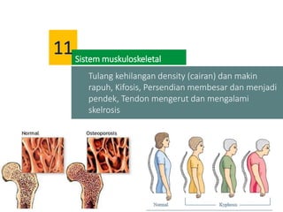 Tulang kehilangan density (cairan) dan makin
rapuh, Kifosis, Persendian membesar dan menjadi
pendek, Tendon mengerut dan mengalami
skelrosis
Sistem muskuloskeletal
11
 