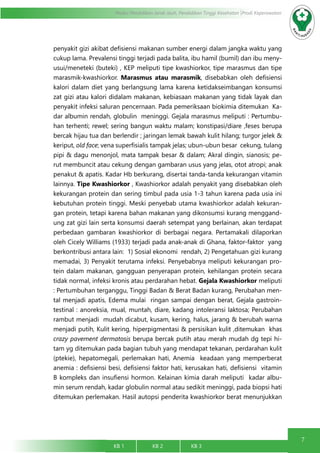 7
Modul Pendidikan Jarak Jauh, Pendidikan Tinggi Kesehatan Prodi Keperawatan
KB 1		 KB 2		 KB 3		
penyakit gizi akibat defisiensi makanan sumber energi dalam jangka waktu yang
cukup lama. Prevalensi tinggi terjadi pada balita, ibu hamil (bumil) dan ibu meny-
usui/meneteki (buteki) , KEP meliputi tipe kwashiorkor, tipe marasmus dan tipe
marasmik-kwashiorkor. Marasmus atau marasmik, disebabkan oleh defisiensi
kalori dalam diet yang berlangsung lama karena ketidakseimbangan konsumsi
zat gizi atau kalori didalam makanan, kebiasaan makanan yang tidak layak dan
penyakit infeksi saluran pencernaan. Pada pemeriksaan biokimia ditemukan Ka-
dar albumin rendah, globulin meninggi. Gejala marasmus meliputi : Pertumbu-
han terhenti; rewel; sering bangun waktu malam; konstipasi/diare ,feses berupa
bercak hijau tua dan berlendir ; jaringan lemak bawah kulit hilang; turgor jelek &
keriput, old face; vena superfisialis tampak jelas; ubun-ubun besar cekung, tulang
pipi & dagu menonjol, mata tampak besar & dalam; Akral dingin, sianosis; pe-
rut membuncit atau cekung dengan gambaran usus yang jelas, otot atropi; anak
penakut & apatis. Kadar Hb berkurang, disertai tanda-tanda kekurangan vitamin
lainnya. Tipe Kwashiorkor , Kwashiorkor adalah penyakit yang disebabkan oleh
kekurangan protein dan sering timbul pada usia 1-3 tahun karena pada usia ini
kebutuhan protein tinggi. Meski penyebab utama kwashiorkor adalah kekuran-
gan protein, tetapi karena bahan makanan yang dikonsumsi kurang menggand-
ung zat gizi lain serta konsumsi daerah setempat yang berlainan, akan terdapat
perbedaan gambaran kwashiorkor di berbagai negara. Pertamakali dilaporkan
oleh Cicely Williams (1933) terjadi pada anak-anak di Ghana, faktor-faktor yang
berkontribusi antara lain: 1) Sosial ekonomi rendah, 2) Pengetahuan gizi kurang
memadai, 3) Penyakit terutama infeksi. Penyebabnya meliputi kekurangan pro-
tein dalam makanan, gangguan penyerapan protein, kehilangan protein secara
tidak normal, infeksi kronis atau perdarahan hebat. Gejala Kwashiorkor meliputi
: Pertumbuhan terganggu, Tinggi Badan & Berat Badan kurang, Perubahan men-
tal menjadi apatis, Edema mulai ringan sampai dengan berat, Gejala gastroin-
testinal : anoreksia, mual, muntah, diare, kadang intoleransi laktosa; Perubahan
rambut menjadi mudah dicabut, kusam, kering, halus, jarang & berubah warna
menjadi putih, Kulit kering, hiperpigmentasi & persisikan kulit ,ditemukan khas
crazy pavement dermatosis berupa bercak putih atau merah mudah dg tepi hi-
tam yg ditemukan pada bagian tubuh yang mendapat tekanan, perdarahan kulit
(ptekie), hepatomegali, perlemakan hati, Anemia keadaan yang memperberat
anemia : defisiensi besi, defisiensi faktor hati, kerusakan hati, defisiensi vitamin
B kompleks dan insufiensi hormon. Kelainan kimia darah meliputi kadar albu-
min serum rendah, kadar globulin normal atau sedikit meninggi, pada biopsi hati
ditemukan perlemakan. Hasil autopsi penderita kwashiorkor berat menunjukkan
 