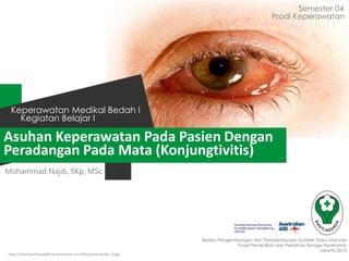 Asuhan Keperawatan Pada Pasien Dengan
Peradangan Pada Mata (Konjungtivitis)
Semester 04
Kegiatan Belajar I
Keperawatan Medikal Bedah I
Badan Pengembangan dan Pemberdayaan Sumber Daya Manusia
Pusat Pendidikan dan Pelatihan Tenaga Kesehatan
Jakarta 2013
Prodi Keperawatan
Mohammad Najib, SKp, MSc
http://salud.practicopedia.lainformacion.com/files/conjuntivitis_0.jpg
 