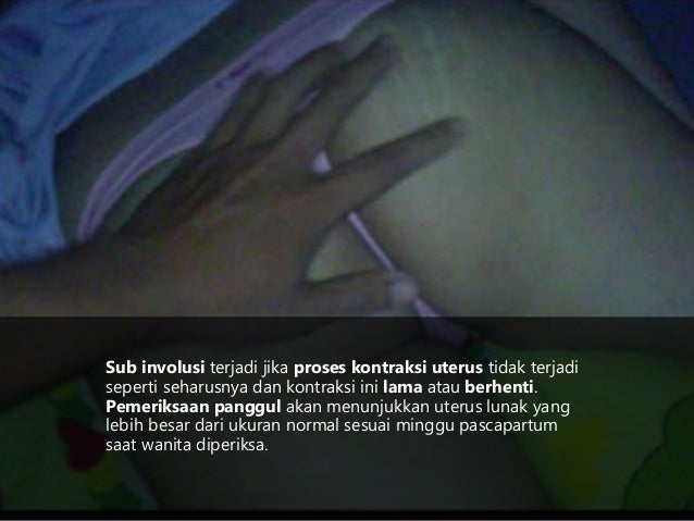 Penyulit Dan Komplikasi Masa Nifas