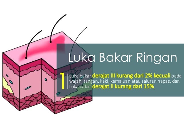 Modul 4 kb 1 penanganan luka bakar