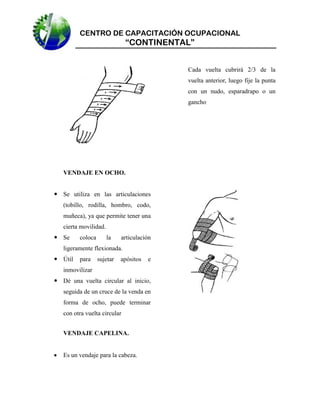 CENTRO DE CAPACITACIÓN OCUPACIONAL

“CONTINENTAL”
Cada vuelta cubrirá 2/3 de la
vuelta anterior, luego fije la punta
con un nudo, esparadrapo o un
gancho

VENDAJE EN OCHO.
 Se utiliza en las articulaciones
(tobillo, rodilla, hombro, codo,
muñeca), ya que permite tener una
cierta movilidad.
 Se

coloca

la

articulación

ligeramente flexionada.
 Útil

para

sujetar

apósitos

e

inmovilizar
 Dé una vuelta circular al inicio,
seguida de un cruce de la venda en
forma de ocho, puede terminar
con otra vuelta circular
VENDAJE CAPELINA.


Es un vendaje para la cabeza.

 