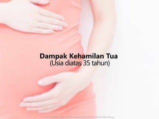 Dampak Kehamilan Tua
(Usia diatas 35 tahun)

http://assets.kompas.com/data/photo/2012/06/28/1414313780x390.jpg

 