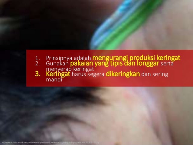Modul 6 kb 3 asuhan neonatus dan bayi dengan seborhea dan