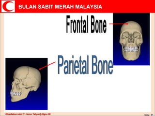 Parietal Bone Frontal Bone 