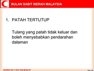 PATAH TERTUTUP Tulang yang patah tidak keluar dan boleh menyebabkan pendarahan dalaman 