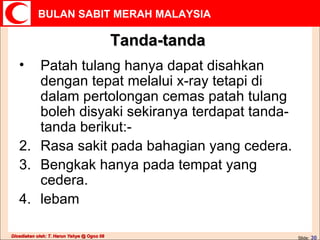 Tanda-tanda Patah tulang hanya dapat disahkan dengan tepat melalui x-ray tetapi di dalam pertolongan cemas patah tulang boleh disyaki sekiranya terdapat tanda-tanda berikut:- Rasa sakit pada bahagian yang cedera. Bengkak hanya pada tempat yang cedera. lebam 