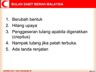 Berubah bentuk Hilang upaya Penggeseran tulang apabila digerakkan (crepitus) Nampak tulang jika patah terbuka. Ada tanda renjatan 