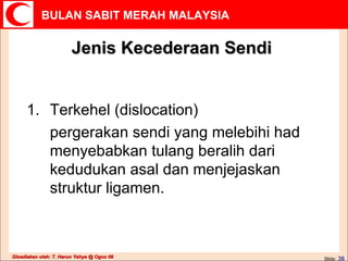 Jenis Kecederaan Sendi Terkehel (dislocation) pergerakan sendi yang melebihi had menyebabkan tulang beralih dari kedudukan asal dan menjejaskan struktur ligamen. 