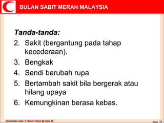 Tanda-tanda: Sakit (bergantung pada tahap kecederaan). Bengkak Sendi berubah rupa Bertambah sakit bila bergerak atau hilang upaya Kemungkinan berasa kebas. 