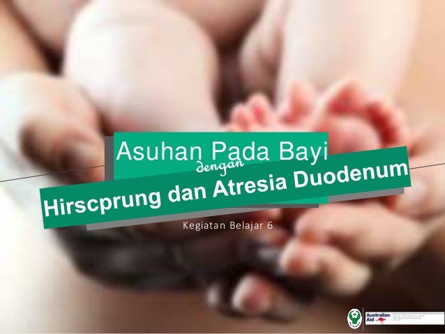 Modul 7 kb 6 asuhan neonatus dan bayi dengan hirscprung Modul 7 kb 6 asuhan neonatus dan bayi dengan hirscprung