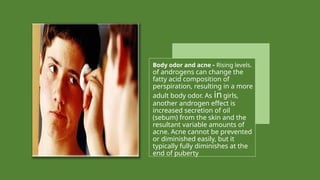 Body odor and acne - Rising levels.
of androgens can change the
fatty acid composition of
perspiration, resulting in a more
adult body odor. As ingirls,
another androgen effect is
increased secretion of oil
(sebum) from the skin and the
resultant variable amounts of
acne. Acne cannot be prevented
or diminished easily, but it
typically fully diminishes at the
end of puberty
 