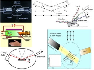 1111
11
1
111
11
11
11
11
11
11
11
1
1
1
1
1
1
1
1
1
1
a
a
v
v
a
θ
ω 2
θ
X-ray
tube
Detector
 