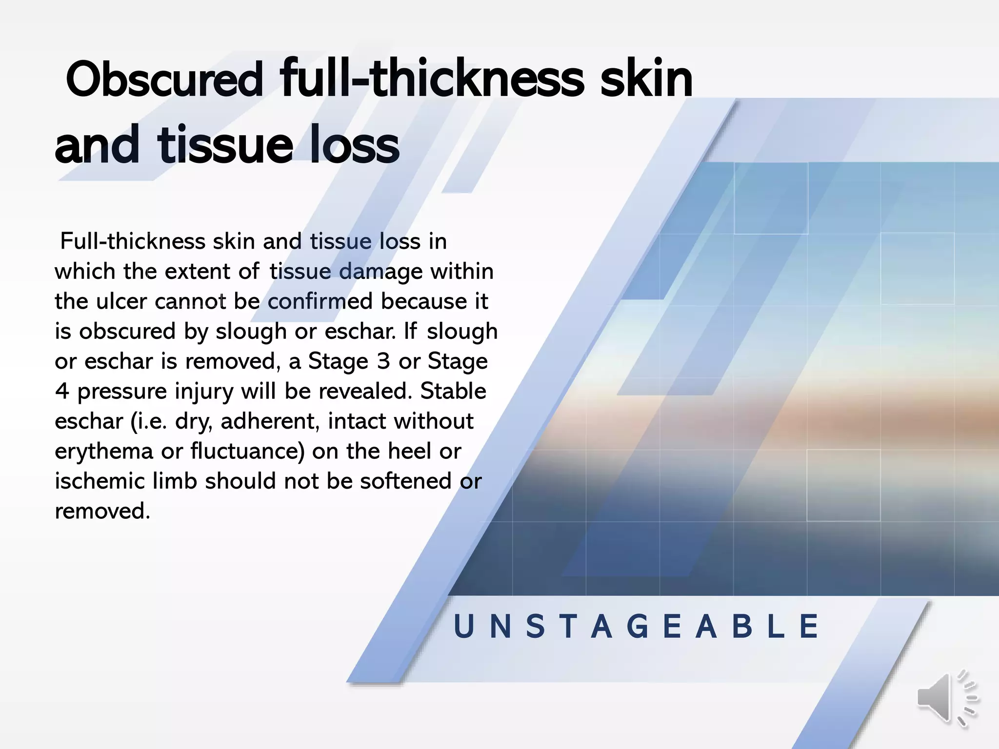 U N S T A G E A B L E
Full-thickness skin and tissue loss in
which the extent of tissue damage within
the ulcer cannot be confirmed because it
is obscured by slough or eschar. If slough
or eschar is removed, a Stage 3 or Stage
4 pressure injury will be revealed. Stable
eschar (i.e. dry, adherent, intact without
erythema or fluctuance) on the heel or
ischemic limb should not be softened or
removed.
Obscured full-thickness skin
and tissue loss
 