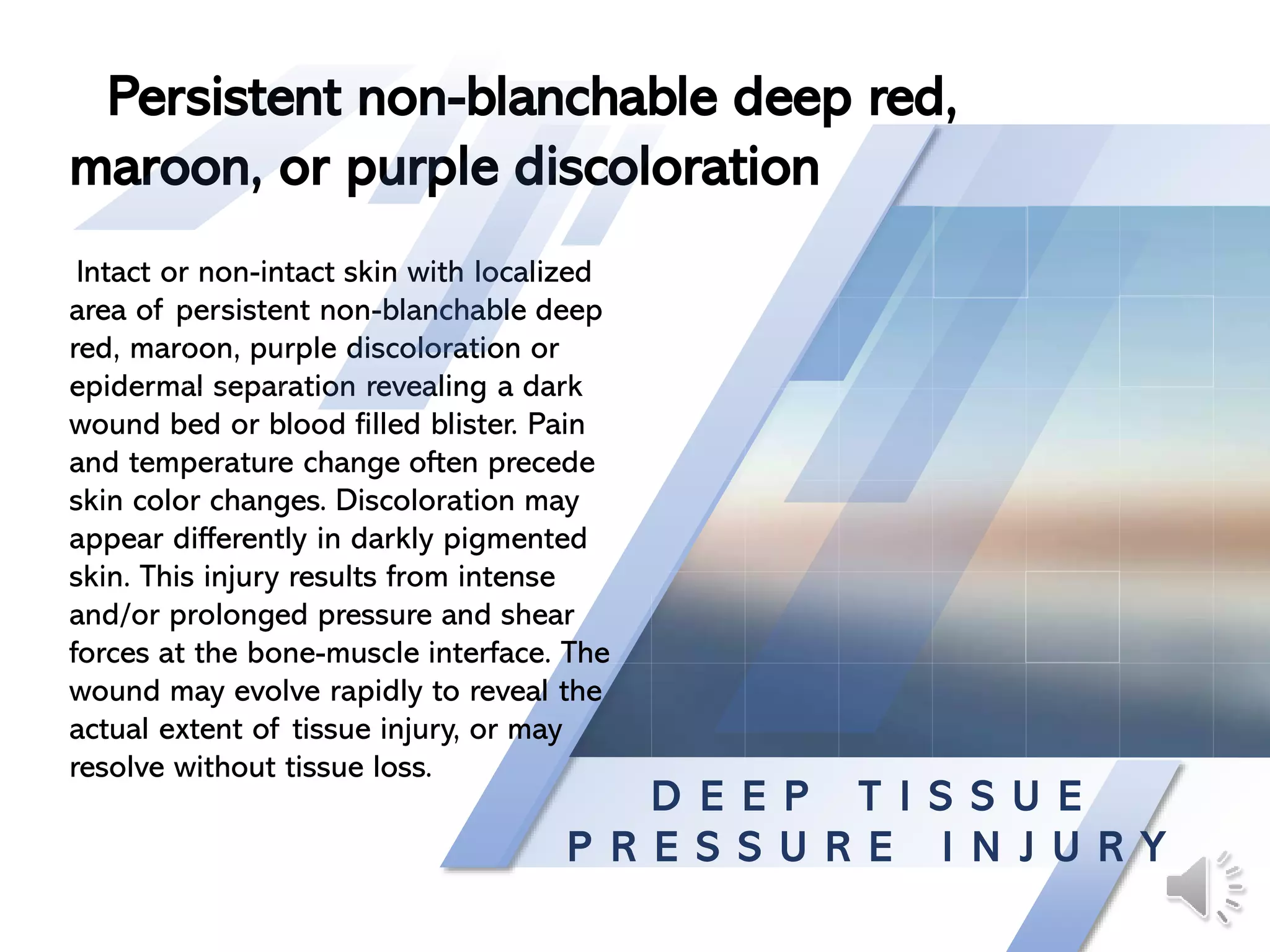 D E E P T I S S U E
P R E S S U R E I N J U R Y
Intact or non-intact skin with localized
area of persistent non-blanchable deep
red, maroon, purple discoloration or
epidermal separation revealing a dark
wound bed or blood filled blister. Pain
and temperature change often precede
skin color changes. Discoloration may
appear differently in darkly pigmented
skin. This injury results from intense
and/or prolonged pressure and shear
forces at the bone-muscle interface. The
wound may evolve rapidly to reveal the
actual extent of tissue injury, or may
resolve without tissue loss.
Persistent non-blanchable deep red,
maroon, or purple discoloration
 