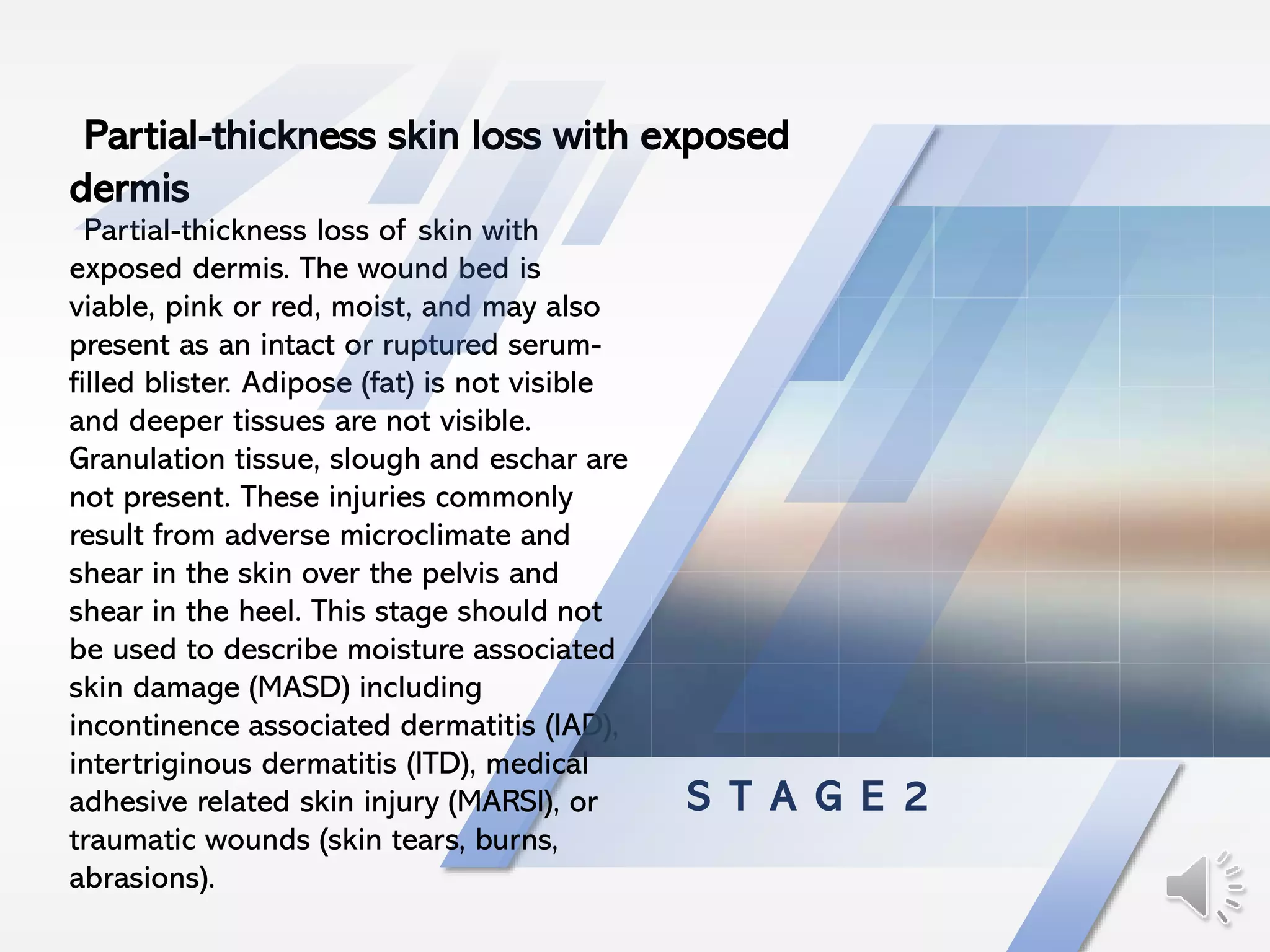 S T A G E 2
Partial-thickness loss of skin with
exposed dermis. The wound bed is
viable, pink or red, moist, and may also
present as an intact or ruptured serum-
filled blister. Adipose (fat) is not visible
and deeper tissues are not visible.
Granulation tissue, slough and eschar are
not present. These injuries commonly
result from adverse microclimate and
shear in the skin over the pelvis and
shear in the heel. This stage should not
be used to describe moisture associated
skin damage (MASD) including
incontinence associated dermatitis (IAD),
intertriginous dermatitis (ITD), medical
adhesive related skin injury (MARSI), or
traumatic wounds (skin tears, burns,
abrasions).
Partial-thickness skin loss with exposed
dermis
 