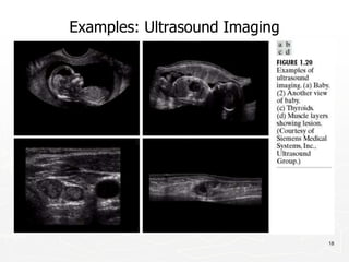 18
Examples: Ultrasound Imaging
 