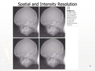 42
Spatial and Intensity Resolution
 