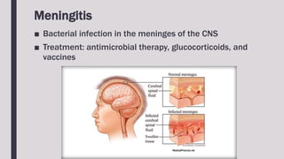 Meningitis
■ Bacterial infection in the meninges of the CNS
■ Treatment: antimicrobial therapy, glucocorticoids, and
vaccines
 
