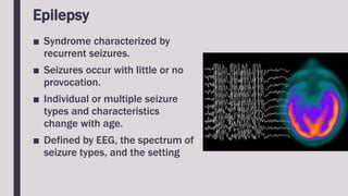 Epilepsy
■ Syndrome characterized by
recurrent seizures.
■ Seizures occur with little or no
provocation.
■ Individual or multiple seizure
types and characteristics
change with age.
■ Defined by EEG, the spectrum of
seizure types, and the setting
 