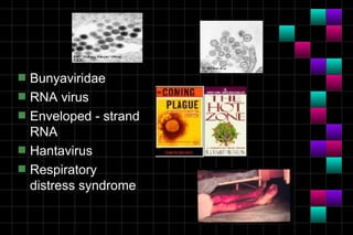 s   Bunyaviridae
s   RNA virus
s   Enveloped - strand
    RNA
s   Hantavirus
s   Respiratory
    distress syndrome
 