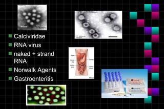 s   Calciviridae
s   RNA virus
s   naked + strand
    RNA
s   Norwalk Agents
s   Gastroenteritis
 