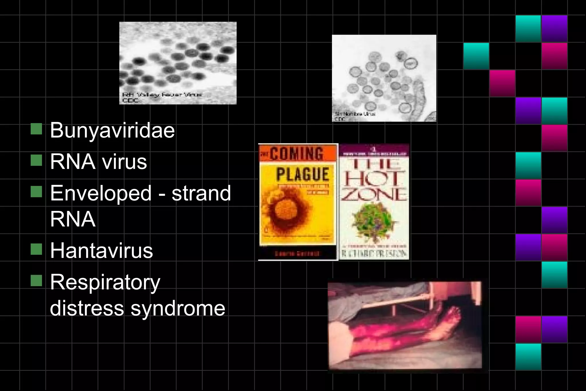 s   Bunyaviridae
s   RNA virus
s   Enveloped - strand
    RNA
s   Hantavirus
s   Respiratory
    distress syndrome
 