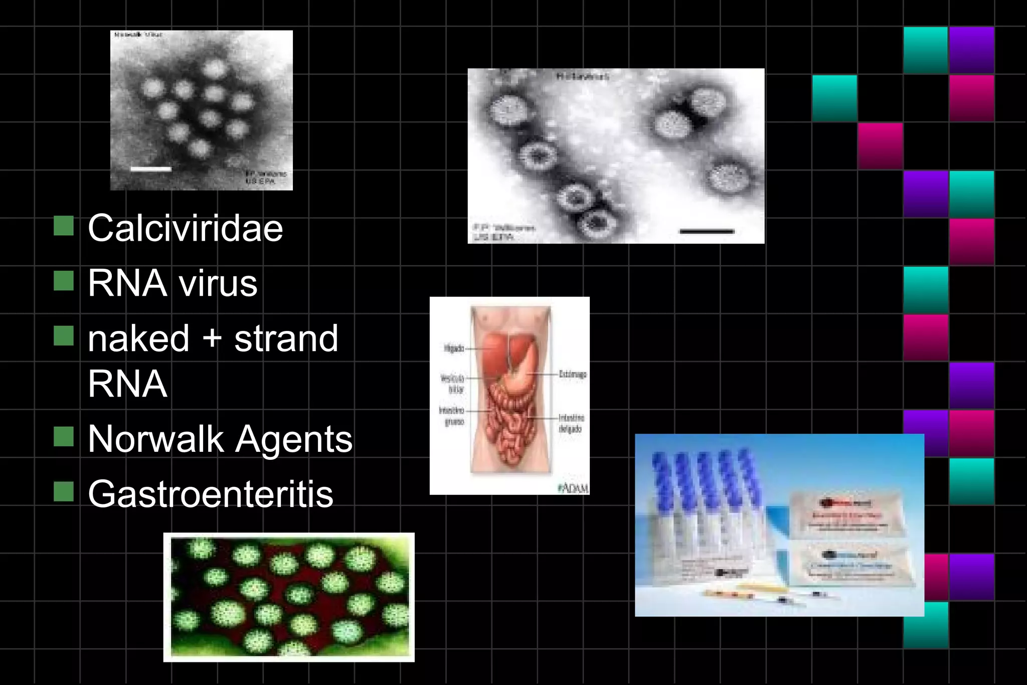 s   Calciviridae
s   RNA virus
s   naked + strand
    RNA
s   Norwalk Agents
s   Gastroenteritis
 