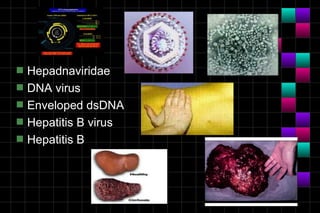 s   Hepadnaviridae
s   DNA virus
s   Enveloped dsDNA
s   Hepatitis B virus
s   Hepatitis B
 