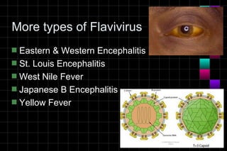 More types of Flavivirus
s Eastern & Western Encephalitis
s St. Louis Encephalitis
s West Nile Fever
s Japanese B Encephalitis
s Yellow Fever
 