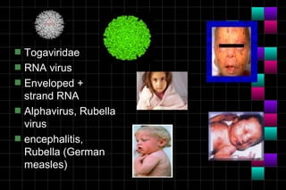 s   Togaviridae
s   RNA virus
s   Enveloped +
    strand RNA
s   Alphavirus, Rubella
    virus
s   encephalitis,
    Rubella (German
    measles)
 