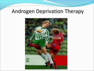 Androgen Deprivation Therapy
 