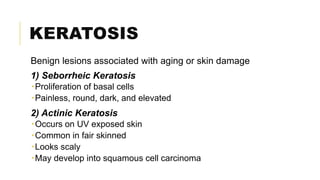 KERATOSIS
Benign lesions associated with aging or skin damage
1) Seborrheic Keratosis
Proliferation of basal cells
Painless, round, dark, and elevated
2) Actinic Keratosis
Occurs on UV exposed skin
Common in fair skinned
Looks scaly
May develop into squamous cell carcinoma
 
