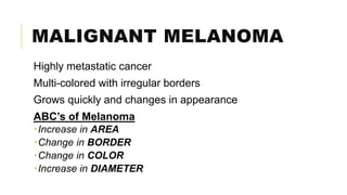 MALIGNANT MELANOMA
Highly metastatic cancer
Multi-colored with irregular borders
Grows quickly and changes in appearance
ABC’s of Melanoma
Increase in AREA
Change in BORDER
Change in COLOR
Increase in DIAMETER
 