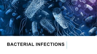 BACTERIAL INFECTIONS
 