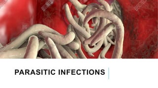 PARASITIC INFECTIONS
 