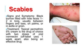 Scabies
•Signs and Symptoms: Black
burrow filled with mite feces 1–
2 in long, usually between
fingers and toes, on palms, or
in axilla or groin.
•Treatment: Topical permethrin
5% cream is the drug of choice
with two doses of oral
ivermectin (off-label use) 1
week apart, also being an
effective drug
 