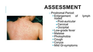 ASSESSMENT
o Prodromal Period:
▪Enlargement of lymph
nodes
•Post-auricular
•Cervical
•Occipital
▪Low-grade fever
▪Malaise
▪Photophobia
▪Cough
▪Coryza
▪Mild GI-symptoms
 