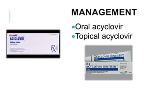 MANAGEMENT
•Oral acyclovir
•Topical acyclovir
 