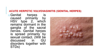 ACUTE HERPETIC VULVOVAGINITIS (GENITAL HERPES)
oGenital herpes is
caused primarily by
HSV type 2, which
remains dormant in the
ganglia of the sacral
nerves. Genital herpes
is spread primarily by
sexual contact. (Will be
discussed in GU
disorders together with
STDs)
 