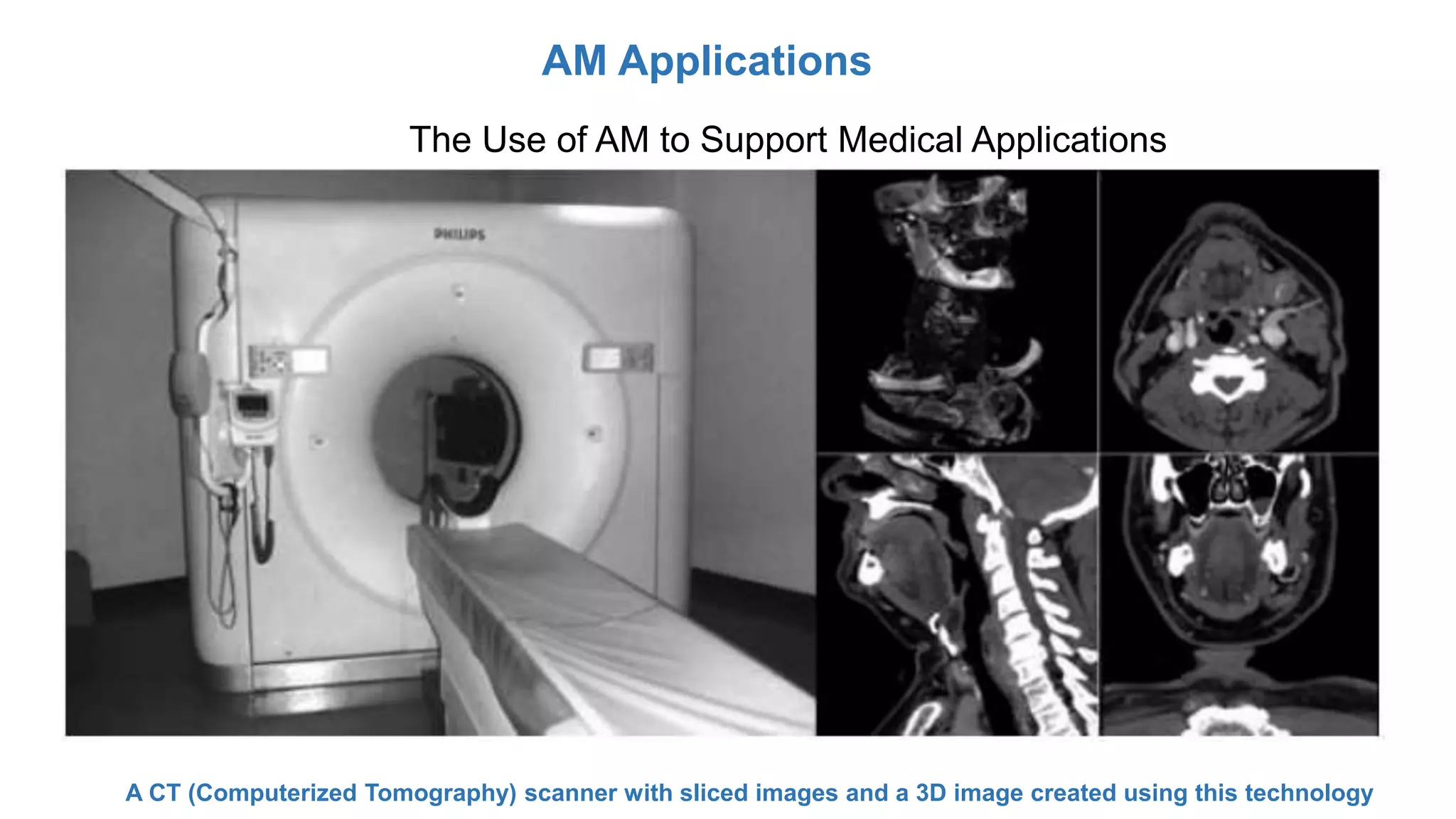 AM Applications
The Use of AM to Support Medical Applications
A CT (Computerized Tomography) scanner with sliced images and a 3D image created using this technology
 