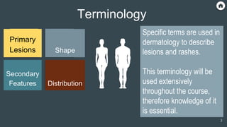 Specific terms are used in
dermatology to describe lesions
and rashes.
This terminology will be used
extensively throughout the
course, therefore knowledge of it
is essential.
Terminology
Primary
Lesions
Secondary
Features
Shape
Distribution
3
Specific terms are used in
dermatology to describe
lesions and rashes.
This terminology will be
used extensively
throughout the course,
therefore knowledge of it
is essential.
 