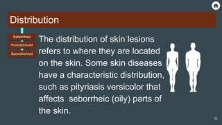 Distribution
The distribution of skin lesions
refers to where they are located
on the skin. Some skin diseases
have a characteristic distribution,
such as pityriasis versicolor that
affects seborrheic (oily) parts of
the skin.
Seborrheic
Photodistributed
Sporotrichoid
30
 