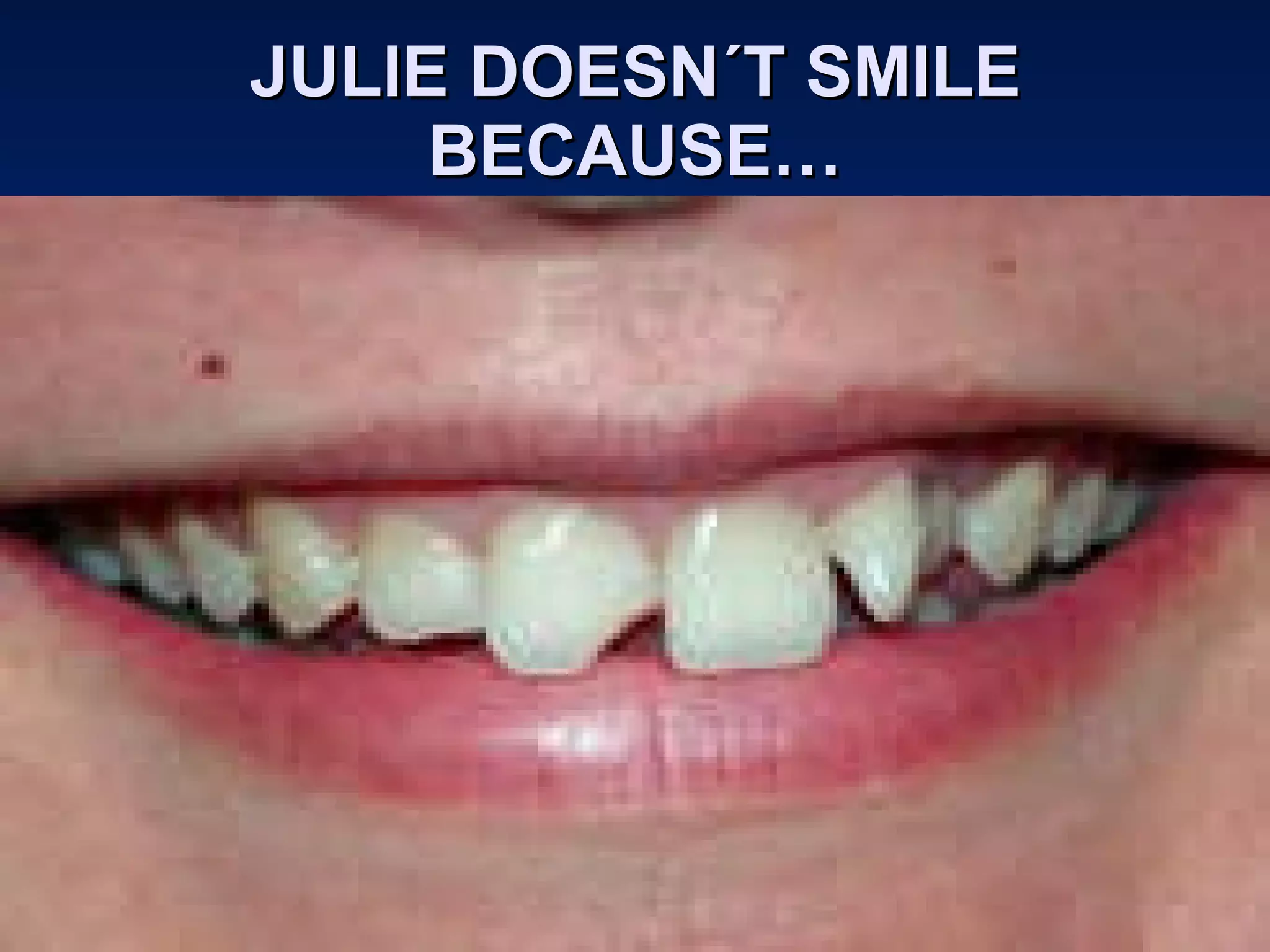 JULIE DOESN´T SMILE BECAUSE… 