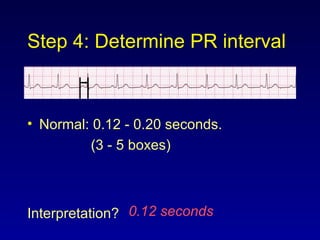 Step 4: Determine PR interval
• Normal: 0.12 - 0.20 seconds.
(3 - 5 boxes)
Interpretation? 0.12 seconds
 