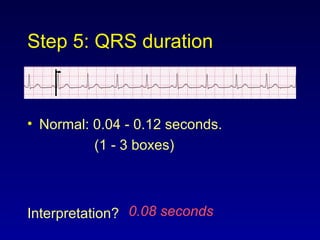 Step 5: QRS duration
• Normal: 0.04 - 0.12 seconds.
(1 - 3 boxes)
Interpretation? 0.08 seconds
 