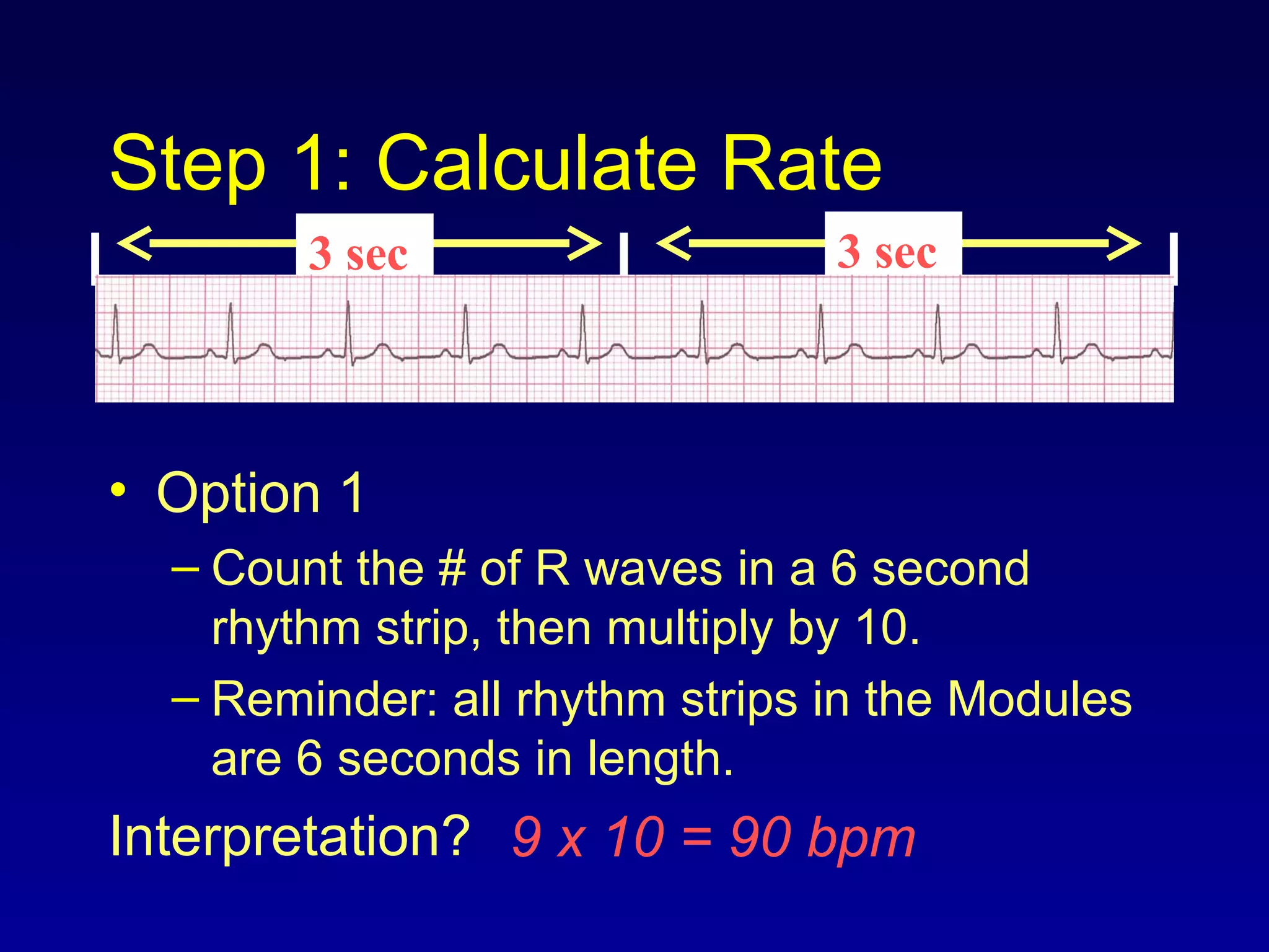 Step 1: Calculate Rate
• Option 1
– Count the # of R waves in a 6 second
rhythm strip, then multiply by 10.
– Reminder: all rhythm strips in the Modules
are 6 seconds in length.
Interpretation? 9 x 10 = 90 bpm
3 sec 3 sec
 