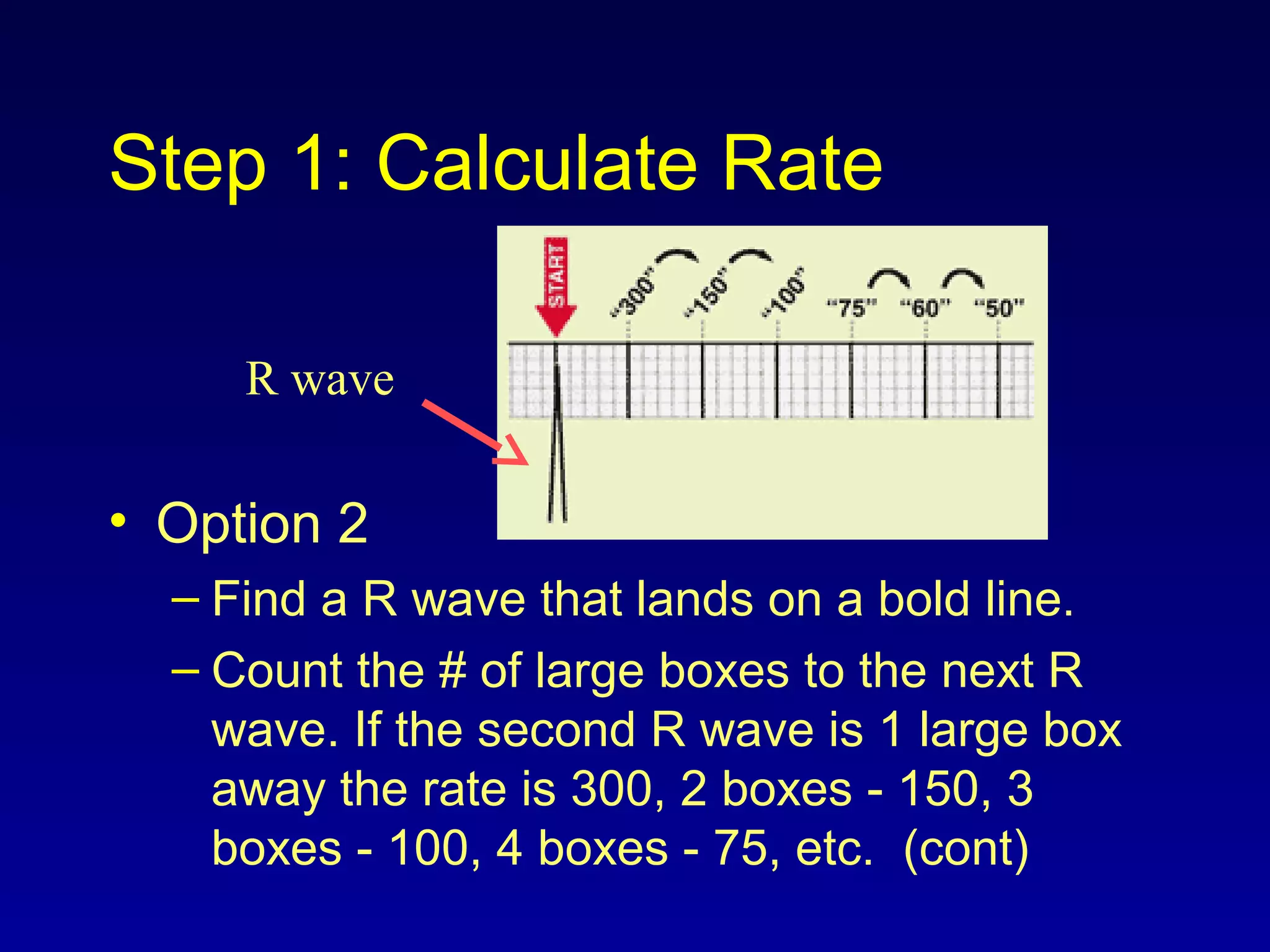 Step 1: Calculate Rate
• Option 2
– Find a R wave that lands on a bold line.
– Count the # of large boxes to the next R
wave. If the second R wave is 1 large box
away the rate is 300, 2 boxes - 150, 3
boxes - 100, 4 boxes - 75, etc. (cont)
R wave
 